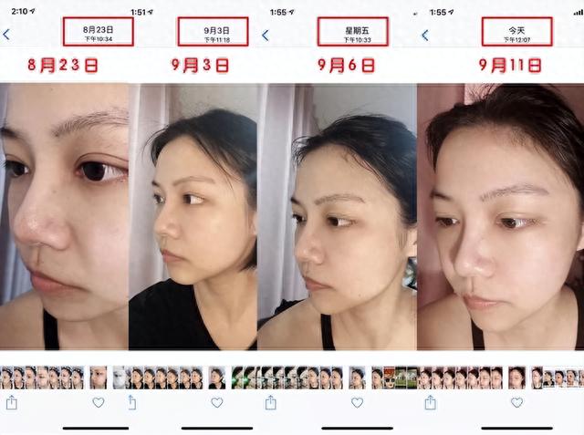 泰国女子连续打了6年“美白针”，如今的变化，网友：难以相信-31.jpg
