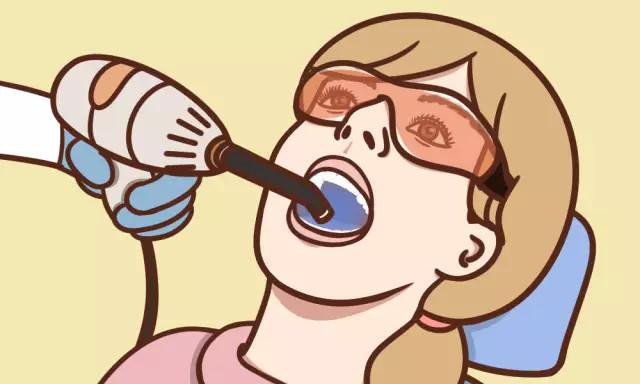 冷光美白会导致牙齿酸痛敏感，这是真的吗？-5.jpg